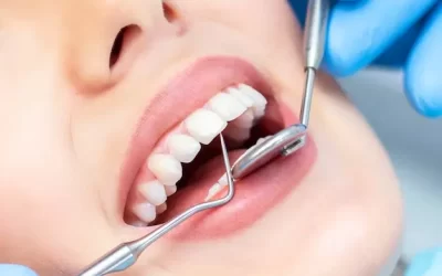 10 Common Dental Problems and Treatment