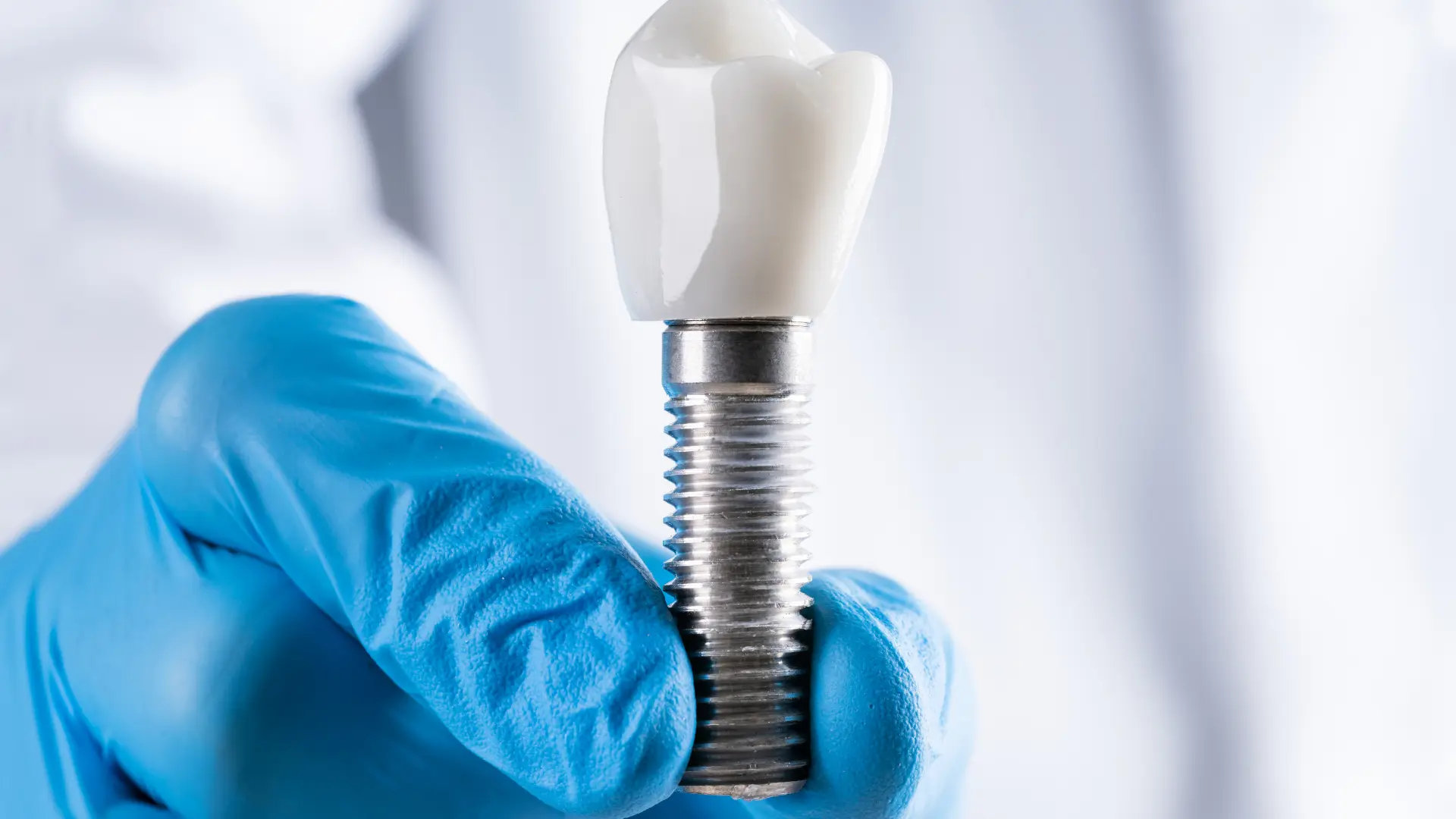 what-are-dental-implants-doctor-holding-tooth-implant
