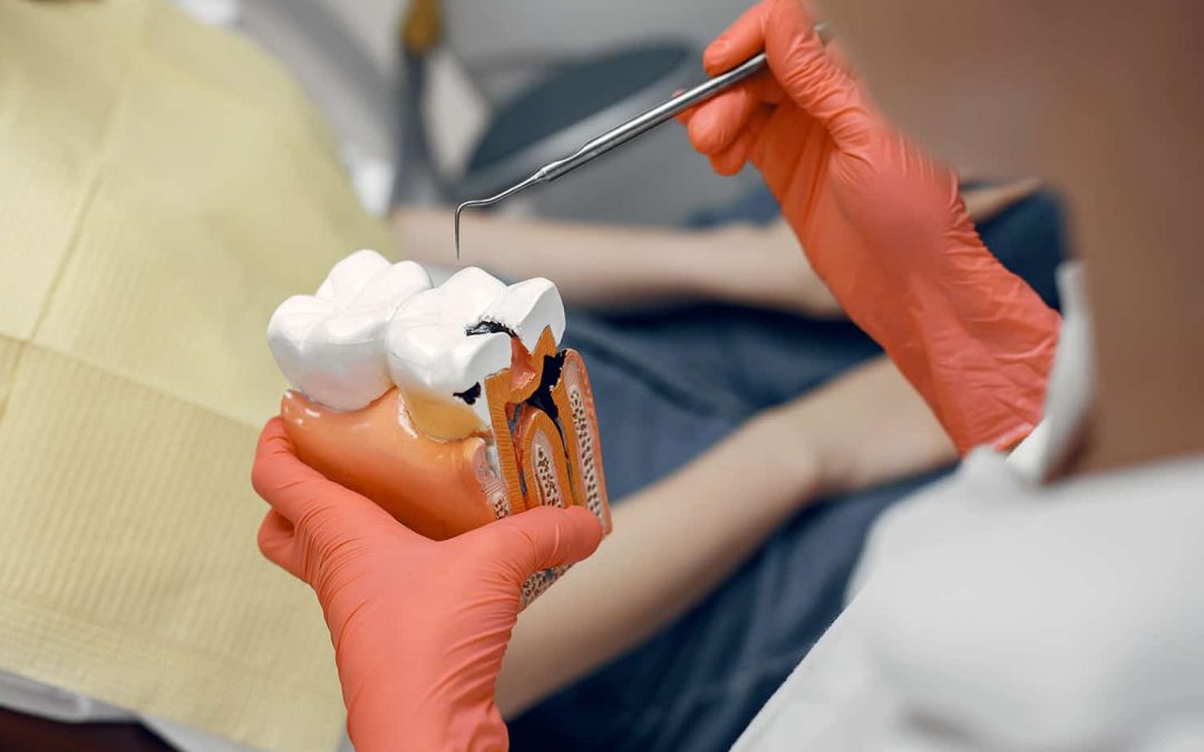 diş minesi aşınması ve tadavisi