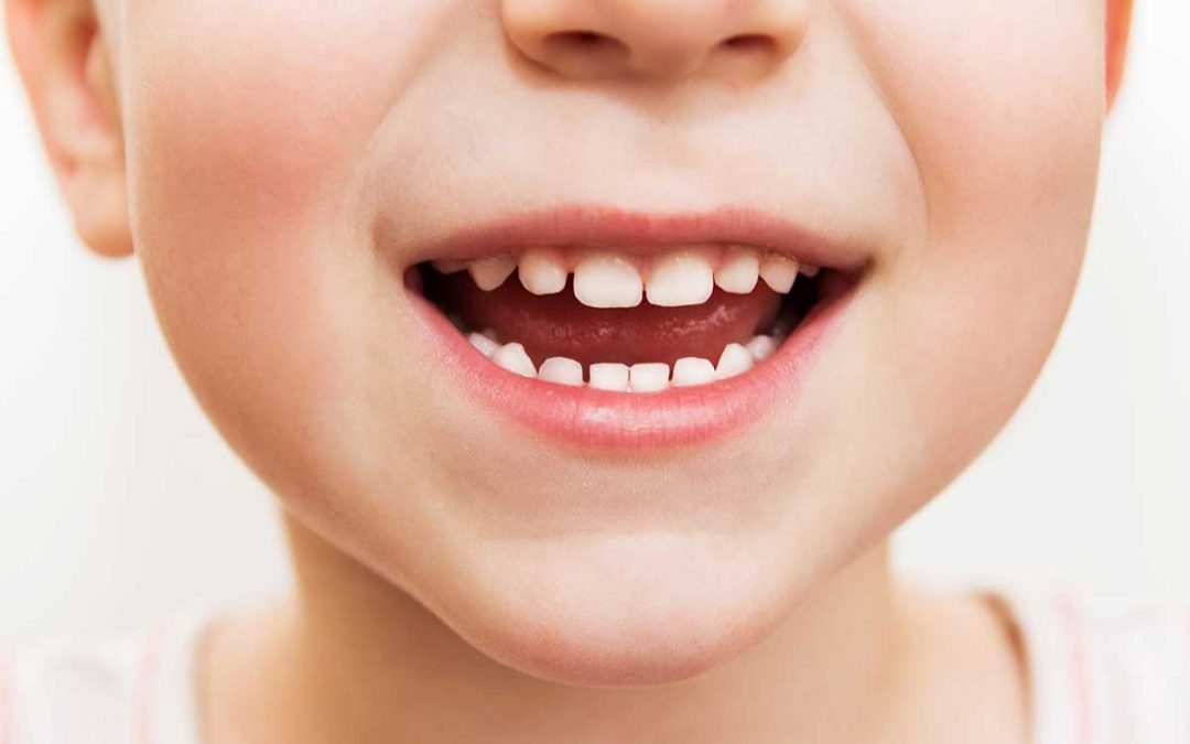 Çocuklar için Diş Muayenesi ne sıklıkla olmalıdır