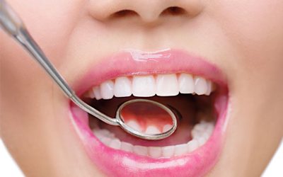 Diş Eti Hastalıkları Belirtileri Nelerdir