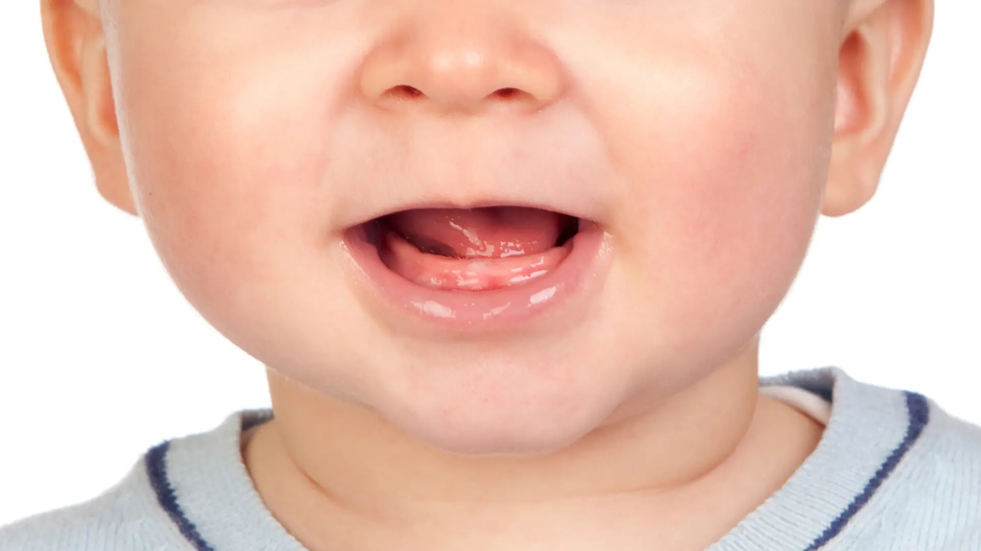 bebeklerde diş eti iltihabı
